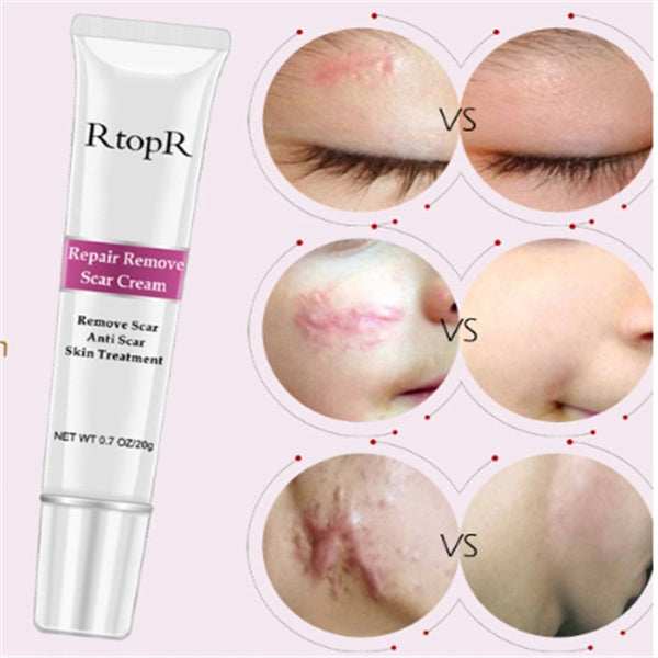 Skin repair cream