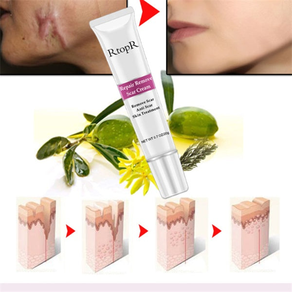 Skin repair cream