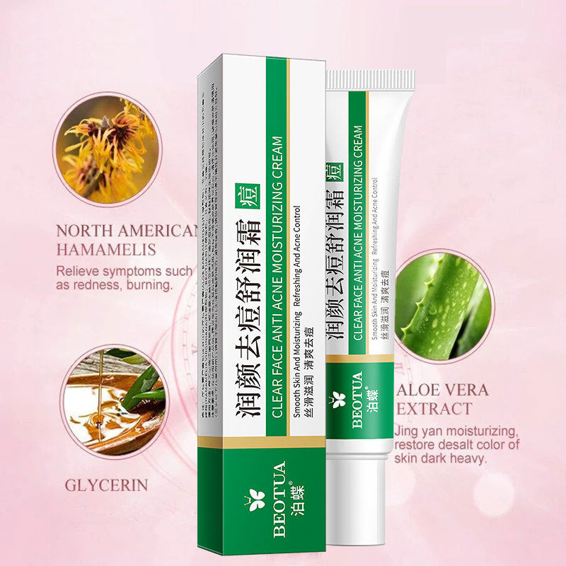 Moisturizing And Acne-relieving Cream Mild Cleansing Skin Care Repair