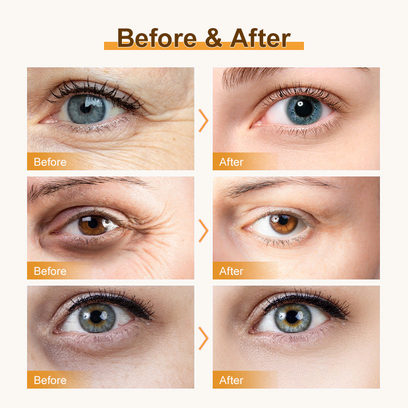 Hydrating, Moisturizing, Improving Eye Care, Eye Lifting And Brightening Essence, Eye Care Cream